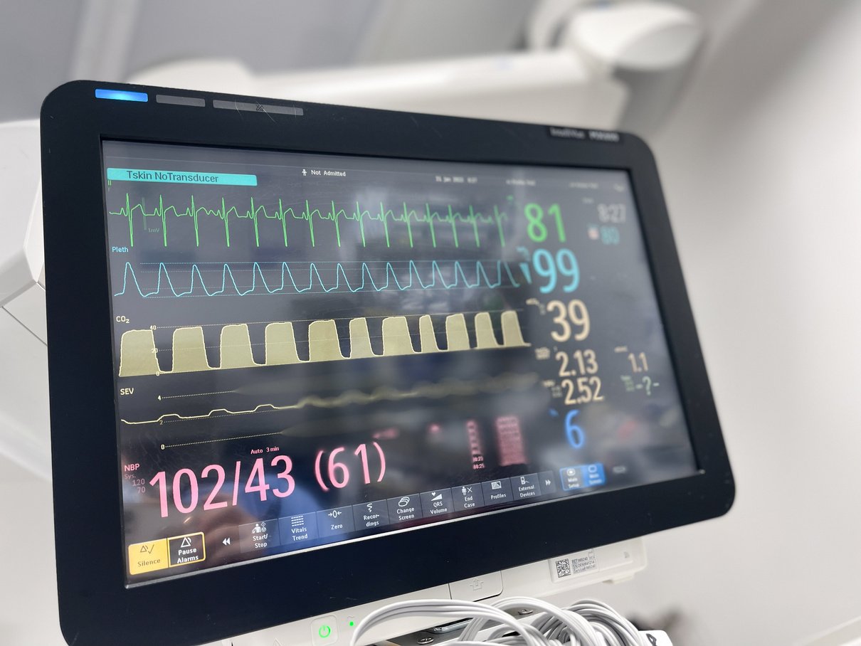 Hospital Monitors electrocardiogram pulse blood pressure anesthesia surgery machines